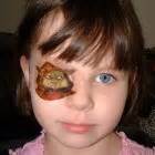 lui oog volwassene